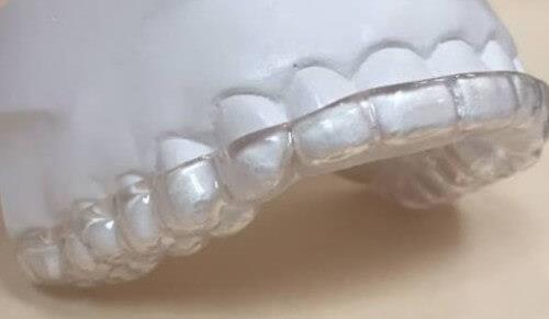 Malvern East Family Dental Bruxism Tooth Wear Model